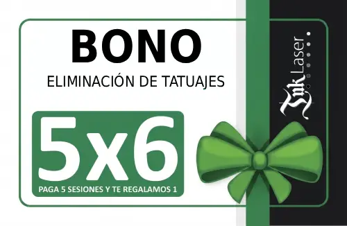 Bono quitar tatuajes precio